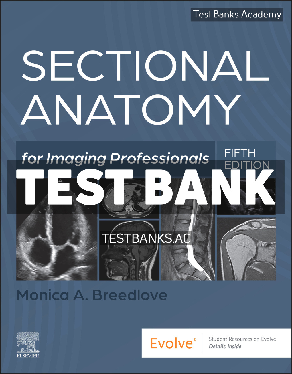 9780323827966-TEST-BANK Sectional Anatomy for Imaging Professionals 5th Breedlove Test Bank